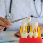 A man placing a dental implant model into some plastic gums.