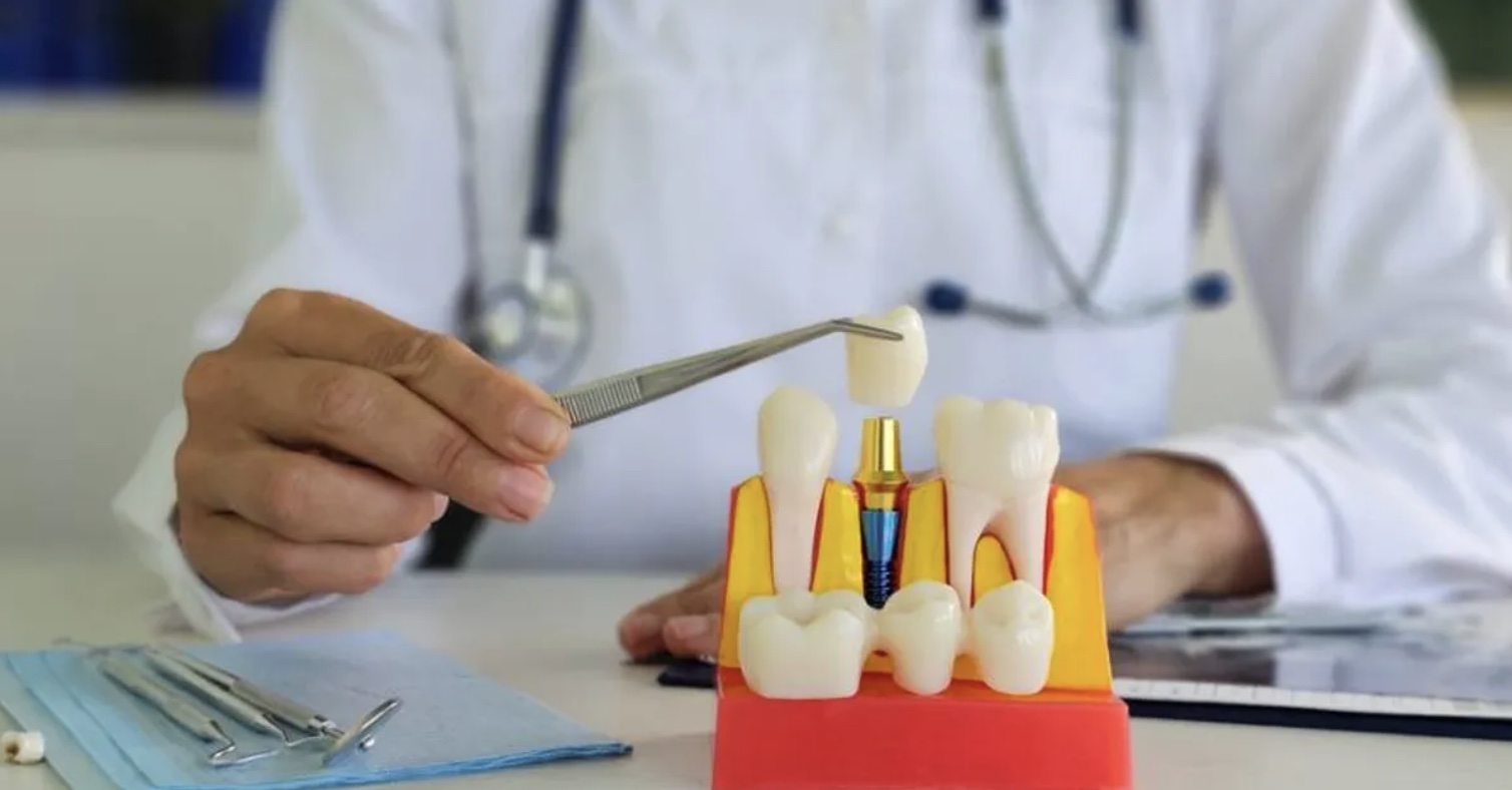 A man placing a dental implant model into some plastic gums.